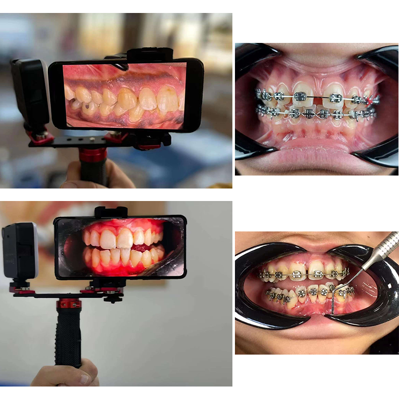 Dentistry Material Mobile Phon - Photography Lighting Material avis et prix